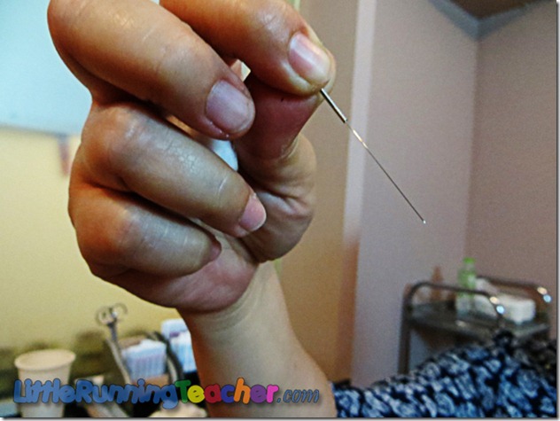 intercare acupuncture